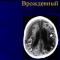 Токсоплазма — паразит в головном мозге